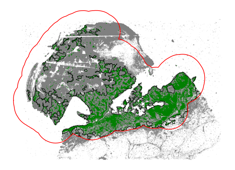 ../_images/tutorial_3_tutorial_immune_infiltration_overlap_15_0.png