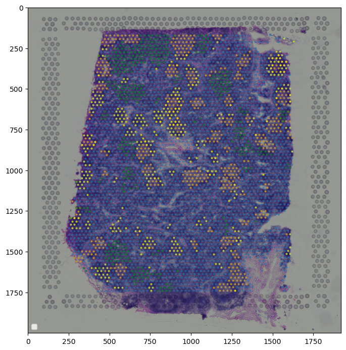 ../_images/tutorial_6_tutorial_visium_cell2location_20_1.png