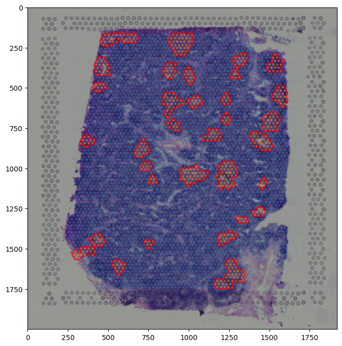 ../_images/tutorial_6_tutorial_visium_cell2location_21_0.png