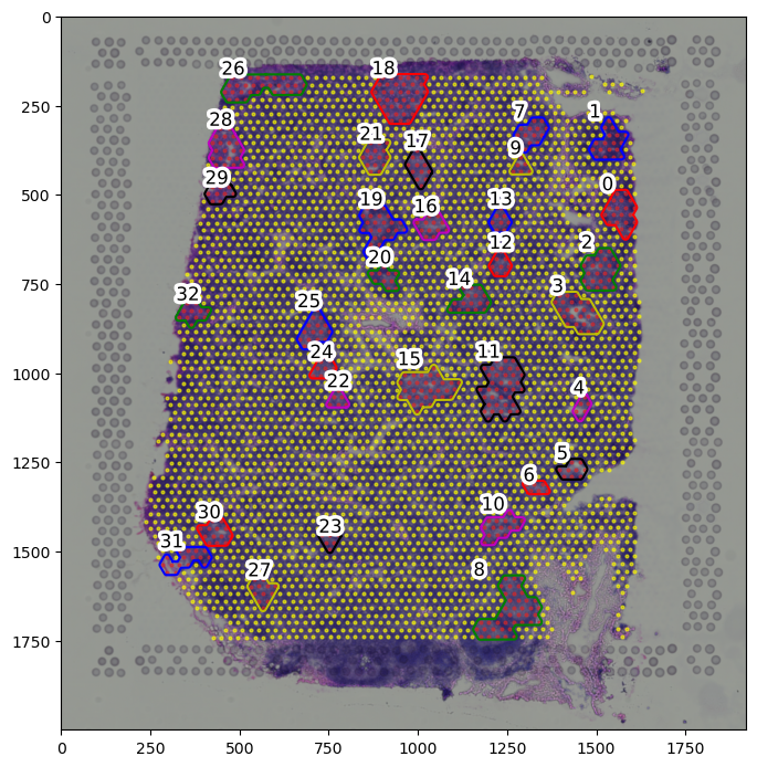 ../_images/tutorial_6_tutorial_visium_cell2location_34_1.png